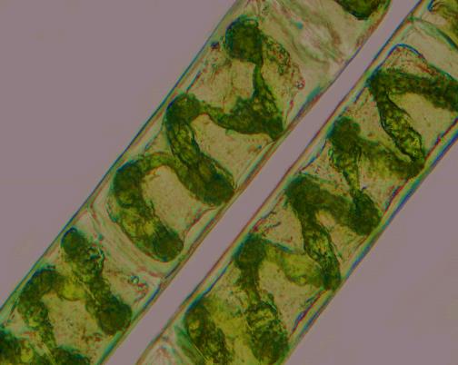 Class_11_Biology_Plant_Kingdom_Spirogyra